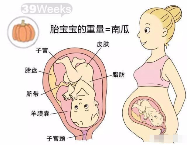 澳门知识专家解析，胎盘低引产方法——针对六个月孕期特殊情况的处理策略